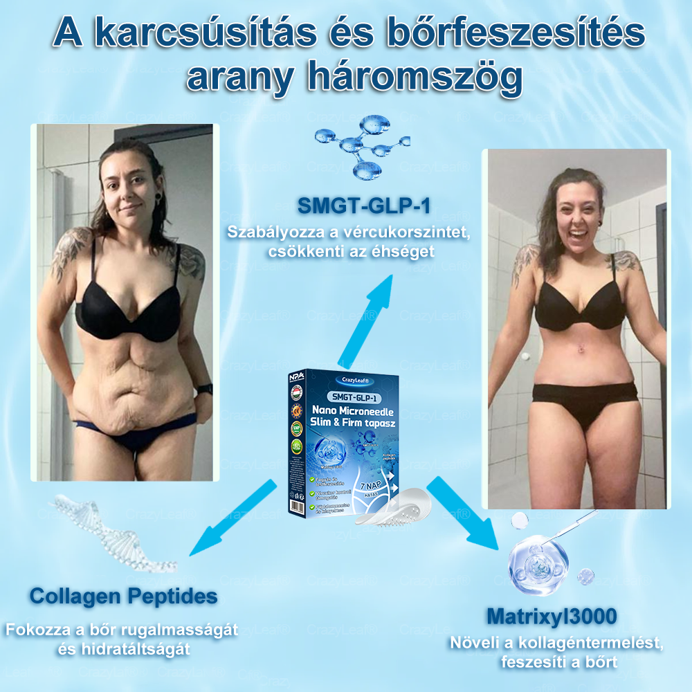 ✨𝐂𝐫𝐚𝐳𝐲𝐋𝐞𝐚𝐟® 𝐒𝐌𝐆𝐓-𝐆𝐋𝐏-𝟏 𝐓𝐚𝐩𝐚𝐬𝐳 – 𝐙𝐬í𝐫é𝐠𝐞𝐭é𝐬, 𝐅𝐞𝐬𝐳𝐞𝐬í𝐭é𝐬, 𝐕é𝐫𝐜𝐮𝐤𝐨𝐫 • 𝟕 𝐧𝐚𝐩 𝐚𝐥𝐚𝐭𝐭 𝐞𝐫𝐞𝐝𝐦é𝐧𝐲, 𝐢𝐧𝐣𝐞𝐤𝐜𝐢ó 𝐧é𝐥𝐤ü𝐥